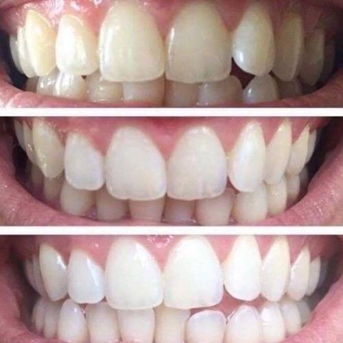 AP 24 Whitening Fluoride Toothpaste - Best Seller.
