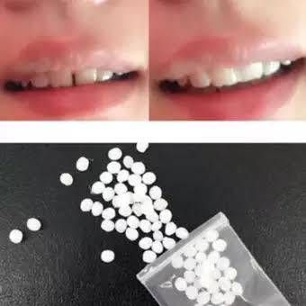 Tooth Repair DIY GAP Repair Kit TOOTH FIXER R170
