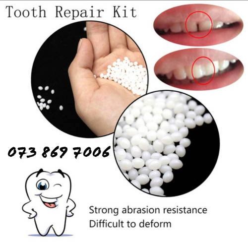 Tooth Repair Kits GAP FIXER
