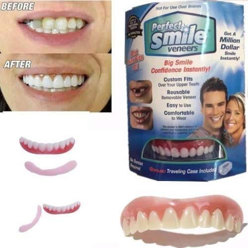 Perfect Smile Top Teeth Veneers
