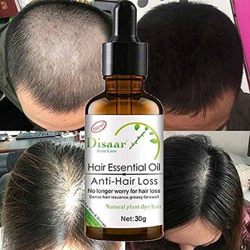 AMAZING GINGER  ANTI - HAIR LOSS , HAIR RE - GROWTH  and  BEARD HAIR GROWTH SERUM