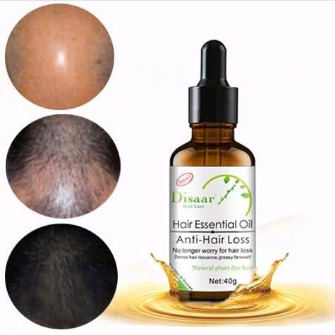 AMAZING GINGER  ANTI - HAIR LOSS , HAIR RE - GROWTH  and  BEARD HAIR GROWTH SERUM