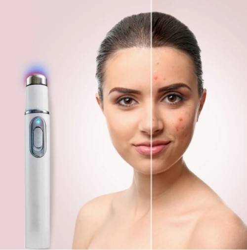 Blue Light Acne, Acne Scars ,Unsightly Veins , Pimples Removal and Repair Laser Therapy Pen