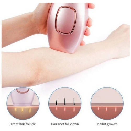 IPL Lazer Hair Removal - Gold