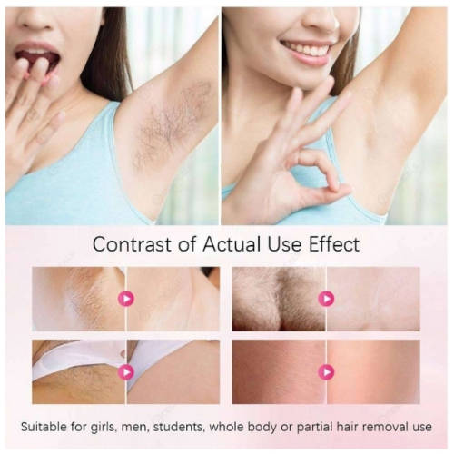 IPL Lazer Hair Removal - Gold