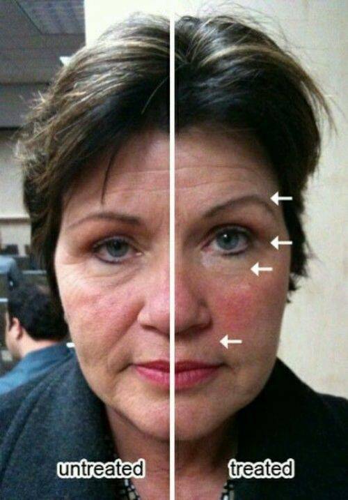 GALVANIC SPA FACIAL GELS WITH AGELOC  3 BOXES OF GELS