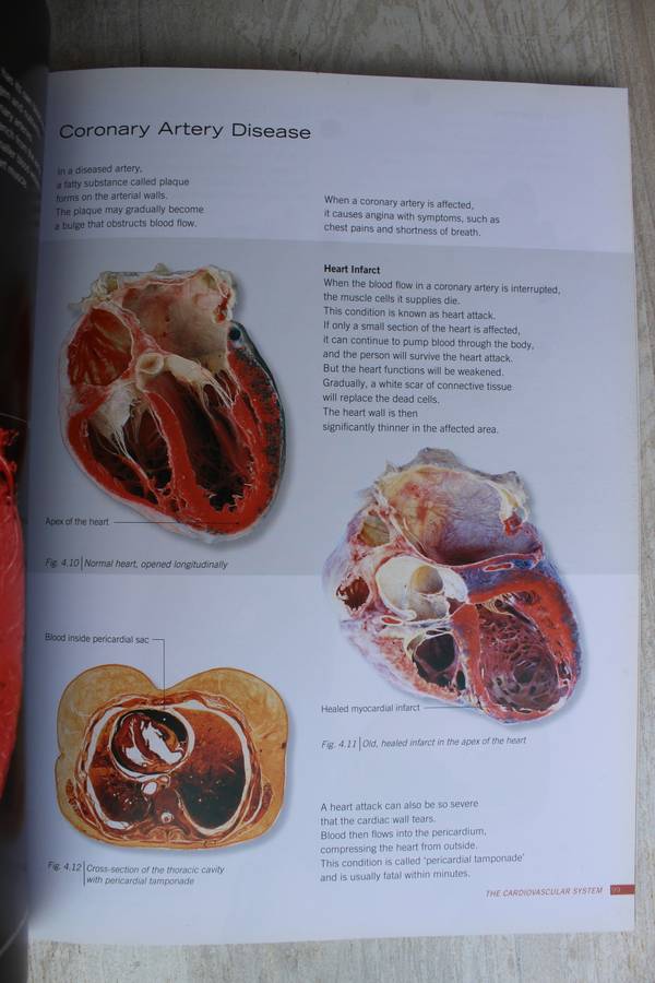 Body Worlds: The Original Exhibition of Real Human Bodies by Gunther von Hagen