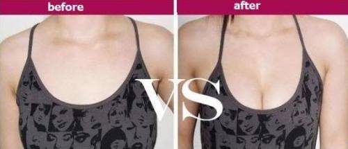 Silicone Nipple Backless Strapless Tube Bra For Bikini Hot Sale