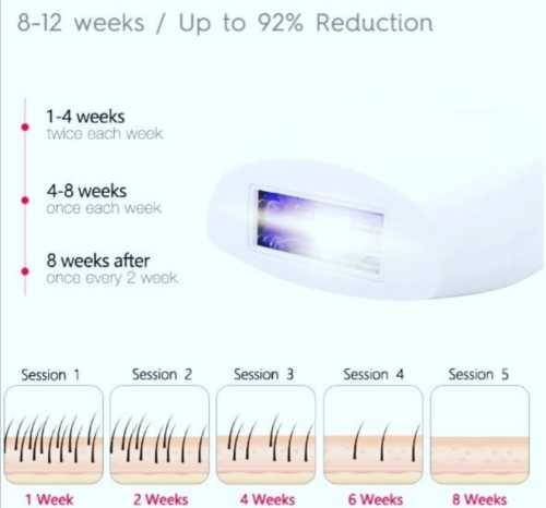 Laser Hair Removal IPL