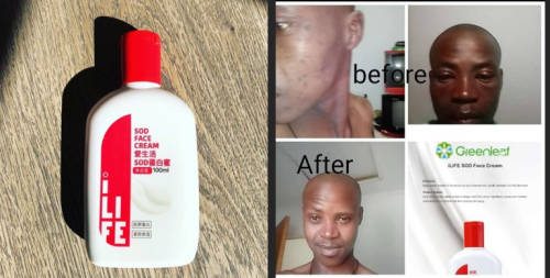 SOD Face Cream