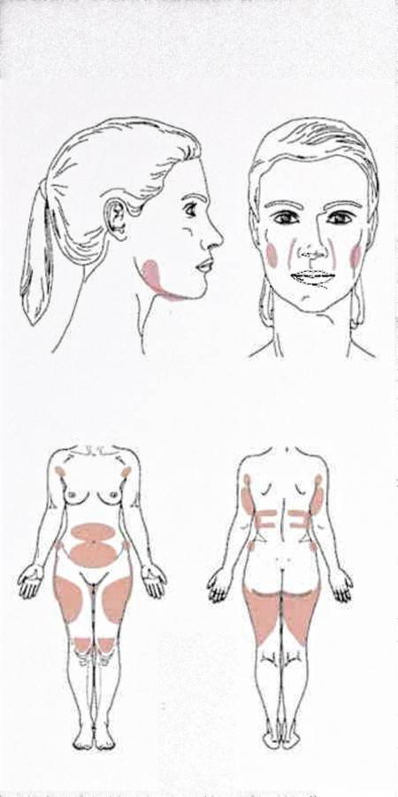 Lipolab PPC Solution - 10ml vial Fat Burner Injection Solution - Weight Loss