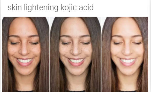 kojic acid powder 10g for skin lightening