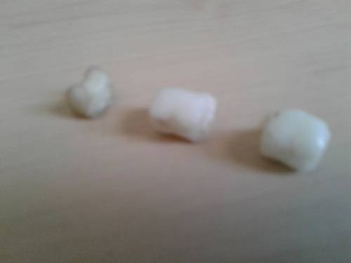 DIY Replacement tooth 5g