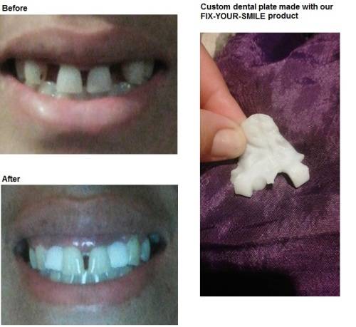 FIX YOUR SMILE - FREE DELIVERY