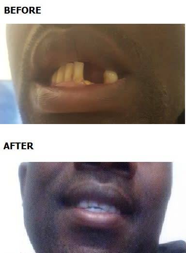 FIX YOUR SMILE - FREE DELIVERY