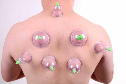 12 Cups Chinese Pull Out Vacuum Cupping Apparatus Therapy Body Massage Pump