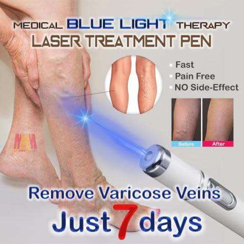 Blue Light Therapy Laser Pen Varicose Vein/ Scar / Acne/ Wrinkle Removal Treatment