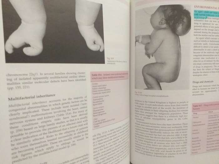 Emery`s Elements of Medical Genetics (R Mueller, I Young)