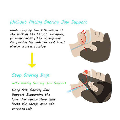 Adjustable Anti Snore Chin Strap Unboxed