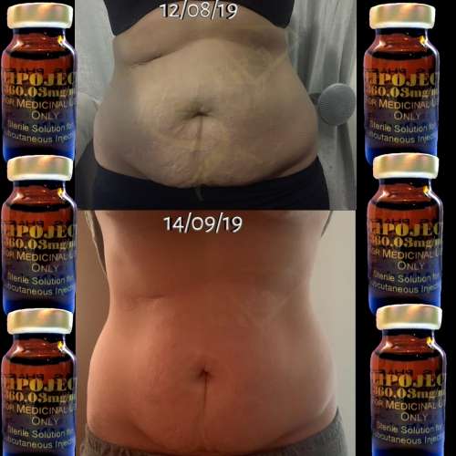 LipoLysis TreatmentEbs Pharma SaFlab To Fab Combo4x Lipojects1x Thinject
