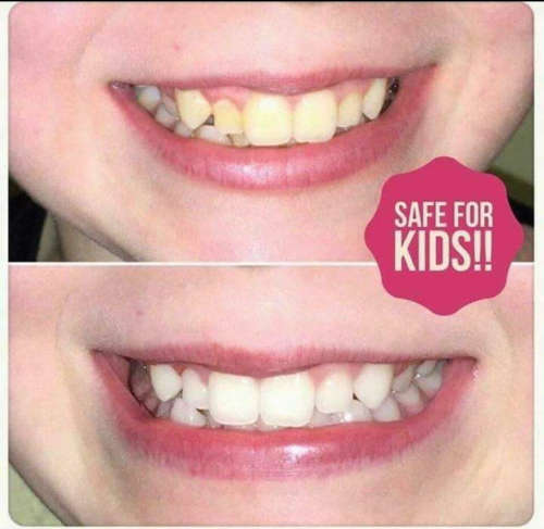 Whitening Fluoride Toothpaste AP 24