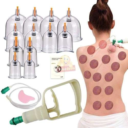 12 Cups Medical Chinese Vacuum Cupping Body Massage Therapy kit
