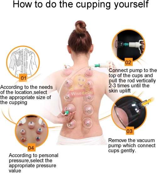 12 Cups Medical Chinese Vacuum Cupping Body Massage Therapy kit