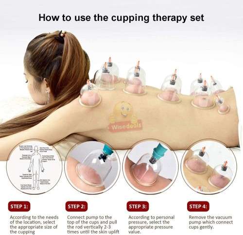 12 Cups Medical Chinese Vacuum Cupping Body Massage Therapy kit