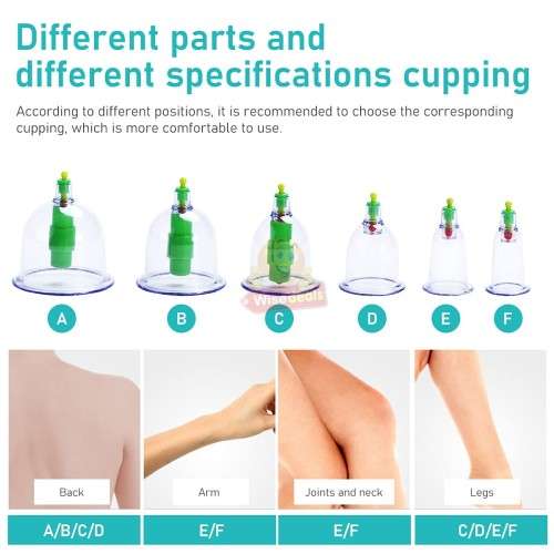 12 Cups Medical Chinese Vacuum Cupping Body Massage Therapy kit
