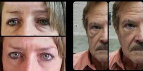 6 Peptides skin serum Argireline, Collagen, Hyaluronic acid.10ml. No Skin Spots,wrinkle,sagging !