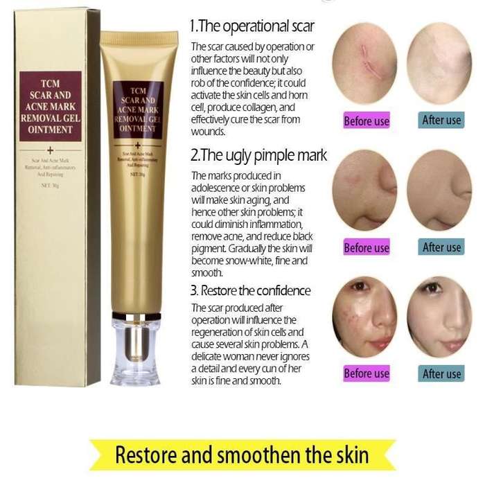 TCM skin scar & acne marks removal gel oitment.30g. anti-inflamatory repair .