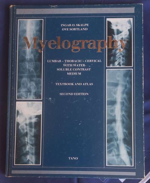 Myelography
