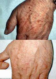 * 20% STRENGTH LACTIC SALON SKIN PEEL AT HOME!! *