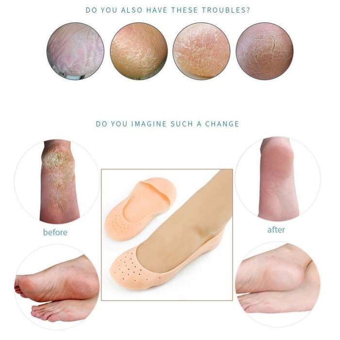 Two Pairs Of Silicone Feet Moisturizing Socks-Care Foot Socks