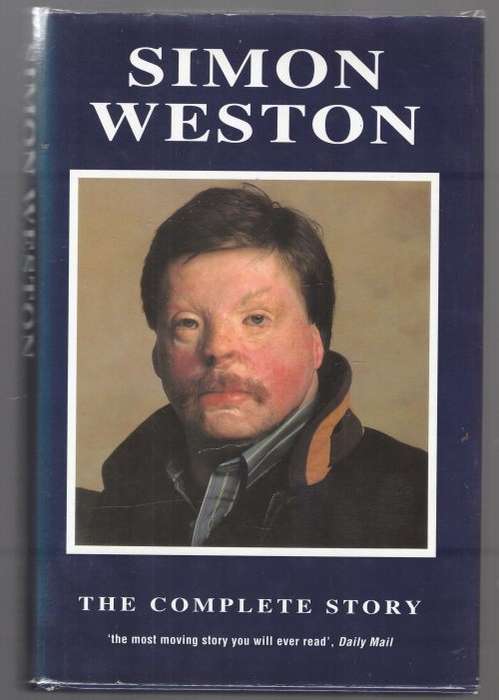 Walking Tall: An Autobiography -- Simon Weston