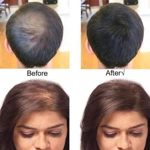 Brilliant Quick Grow Hair Re-Growth and Anti - Hair Loss  Shampoo and Conditioner combo