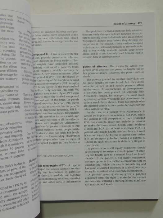 The A - Z of Alzeimer`s Disease, Concise Guide to Understanding & Coping with this Devastating Disea