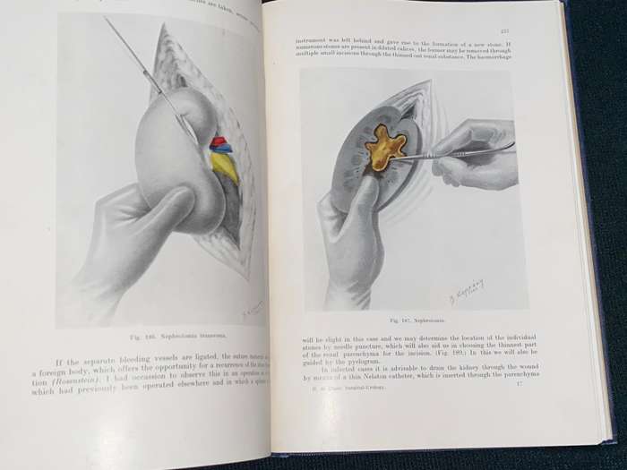 SURGICAL-UROLOGY BY DR. G DE ILLYES 1942