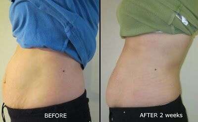 * SPECIAL - Lipotropic Slimming Injections - 40's