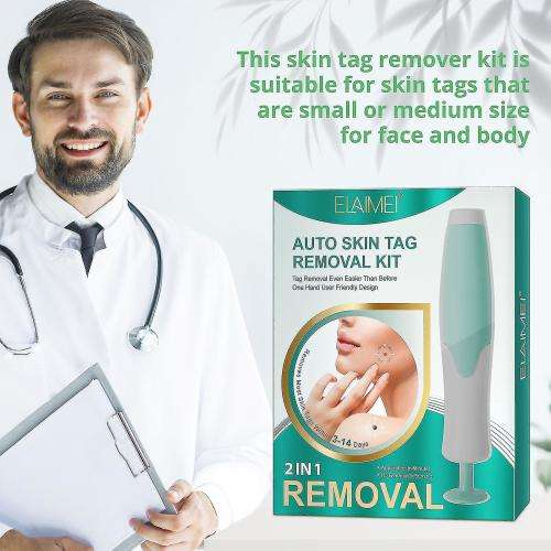Skin Tag Remover Kit - THAT WORKS!