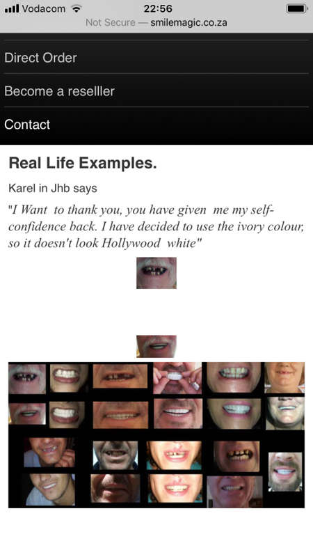 Instant Smile Kits