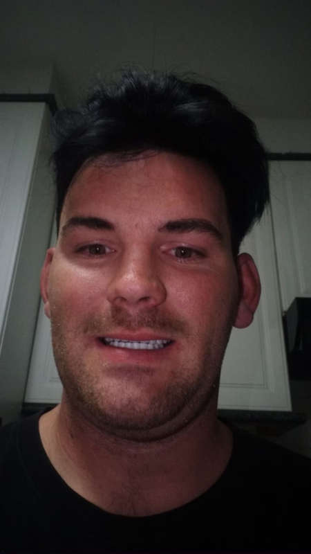 Instant Smile Kits