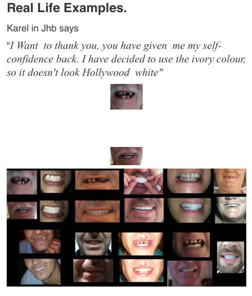 Instant Smile Kits