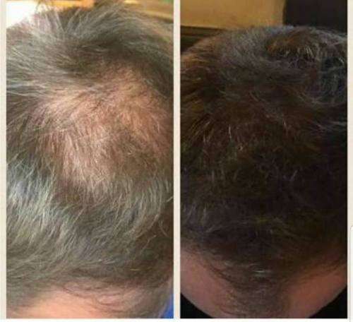 Nutriol Hair Growth Shampoo