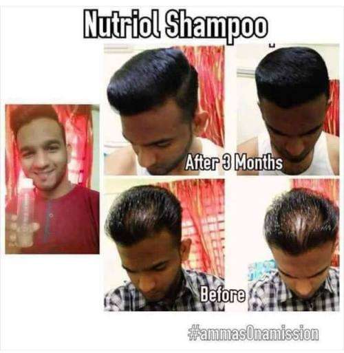 Nutriol Hair Growth Shampoo