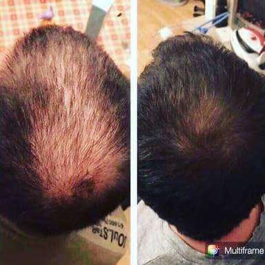 Nutriol Hair Growth Shampoo