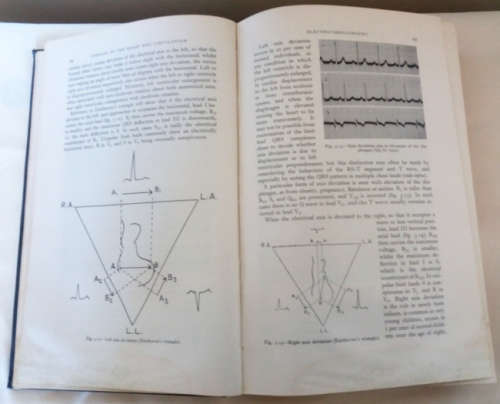 Diseases of the heart and circulation and Digitalis and other cardiotonic drugs - 2 medical books