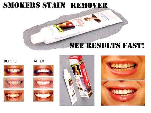 Stain Remover Toothpaste