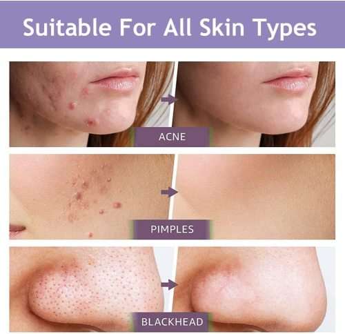 40g Stick Mask