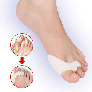 Toe Corrector